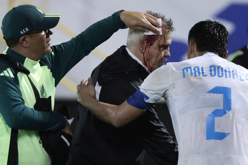 Mexico's coach, Javier Aguirre (C), is helped by an assistant and Honduras' defender #02 Denil Maldonado after being injured in the head when he wa...